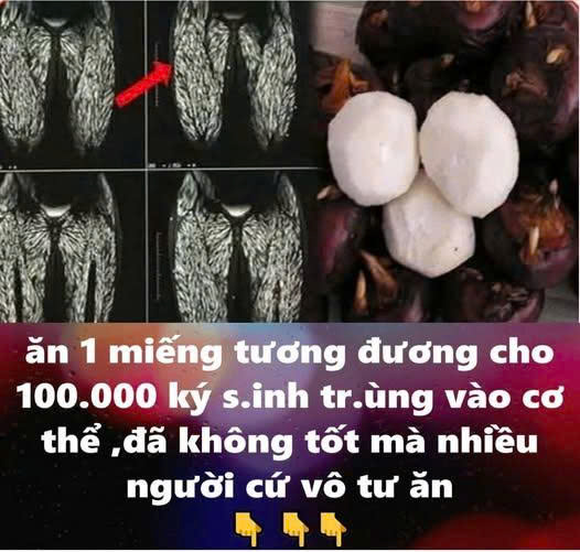 Ăn một miếng tương đương cho 100.000 con ký s i nh trù ng vào b ụng